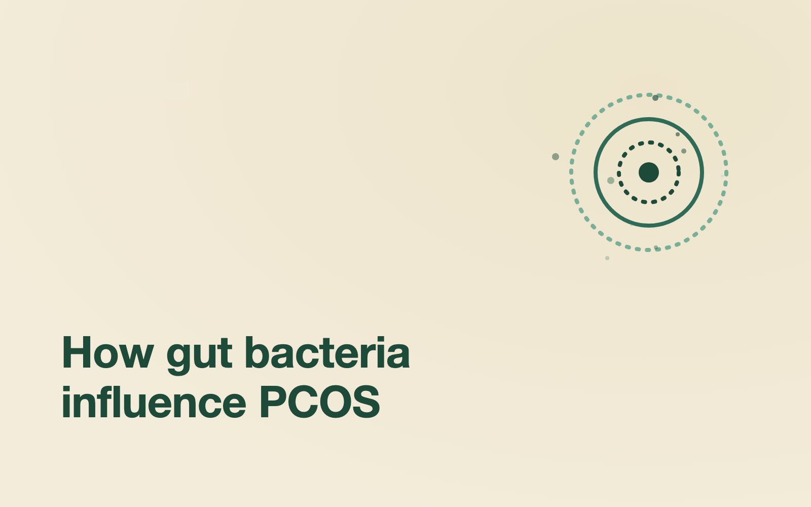 The gut-PCOS connection isn't just correlation